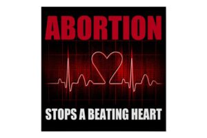 Abortion stops a beating heart